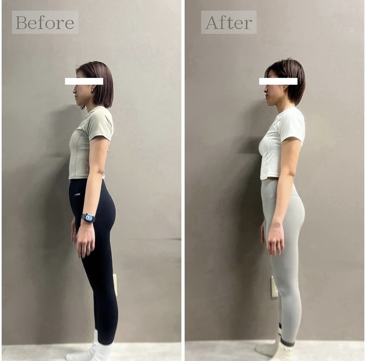 before&after
