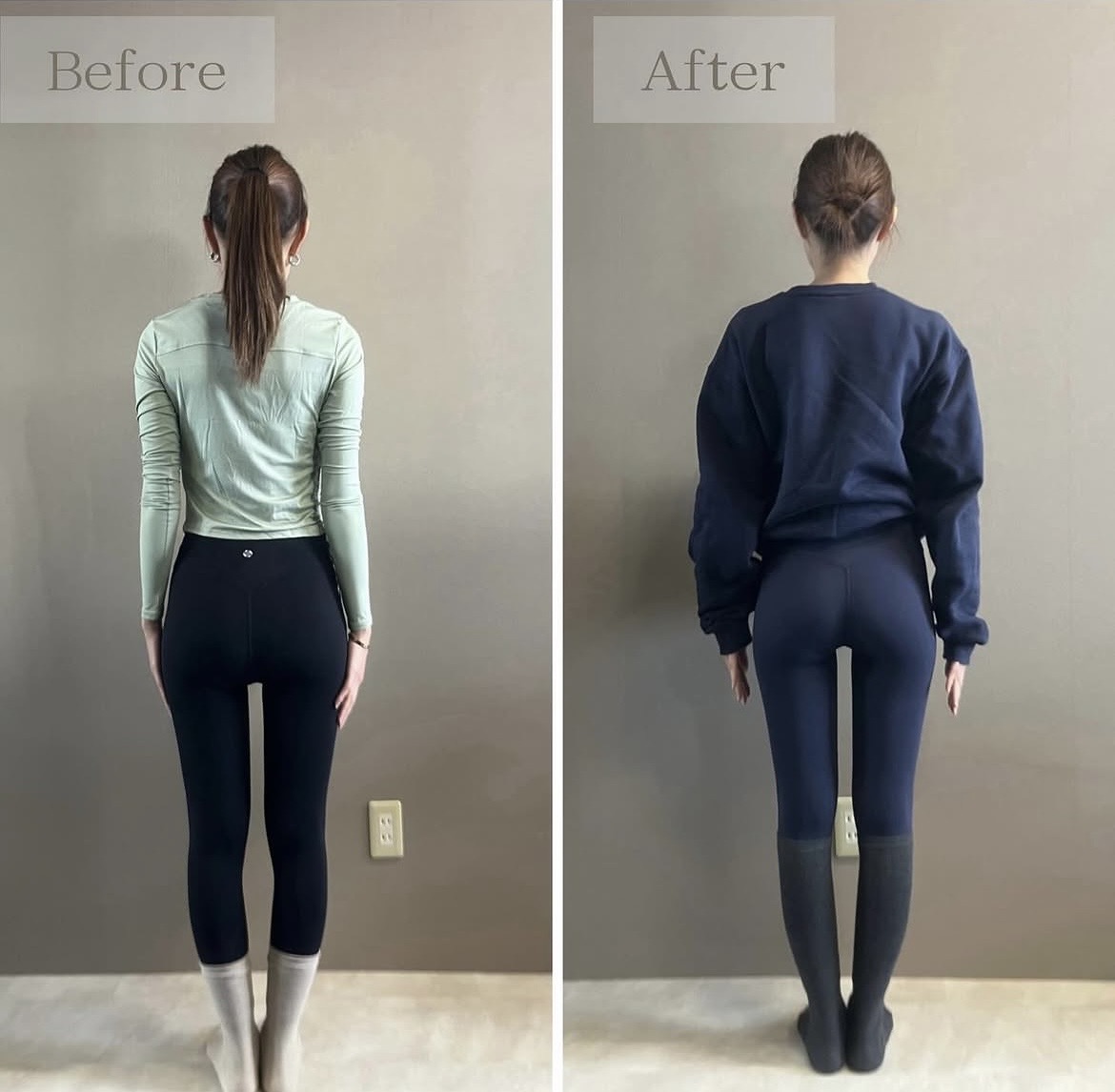 before&after